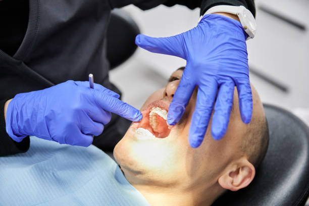 Best Emergency Treatment for Dental Infections or Abscesses in Aurora, MN